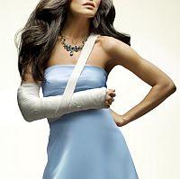 gyógytorna csonttörés után